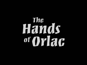 The Hands Of Orlac